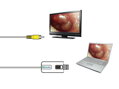 MD VIDEO OTOSKOP  -  2 sondy