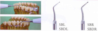 SBL.SBDL.SBR.SBDR koncovka UOZK na preparáciu cavity