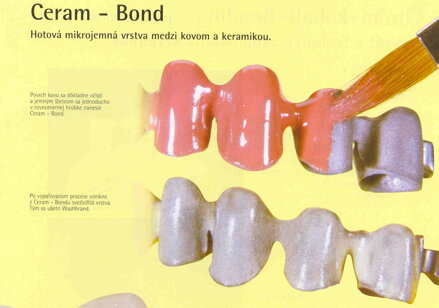 Ceram - Bond