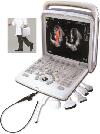 CHISON Q 5 COLOURDOPPLER