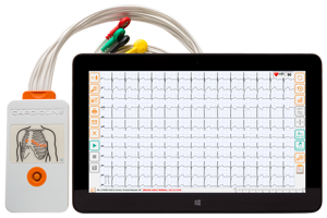 touchecg HD tablet EKG